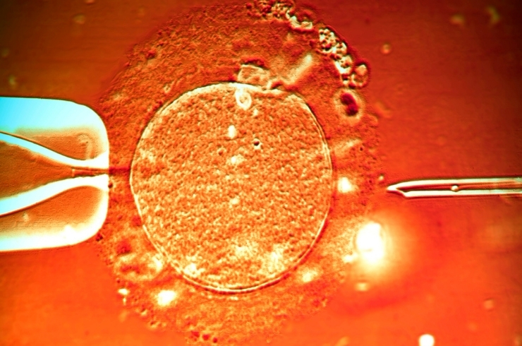 Sree Fertility Centre