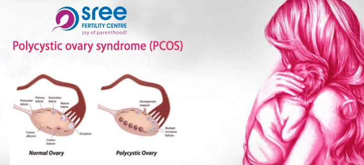 Sree Fertility Centre